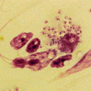 Protozoa